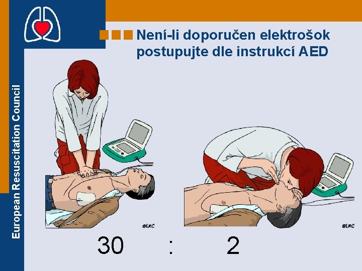 European Resuscitation Council Není-li doporučen elektrošok postupujte dle instrukcí AED 30 : 2 European Resuscitation Council Není-li doporučen elektrošok postupujte dle instrukcí AED 30 : 2