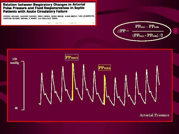 Am J Respir Crit Care Med 2000; 162: 134 -8 ∆PP = 120 mm.