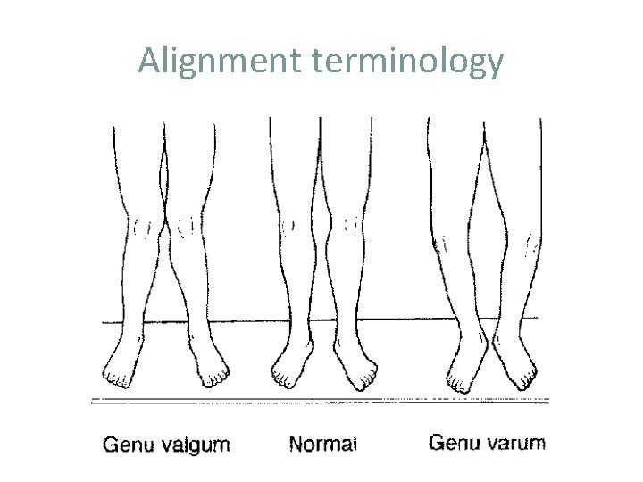Alignment terminology 