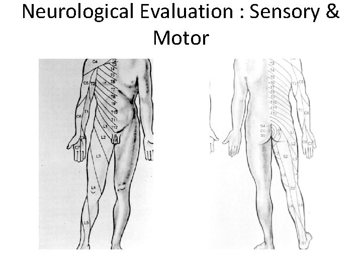 Neurological Evaluation : Sensory & Motor 
