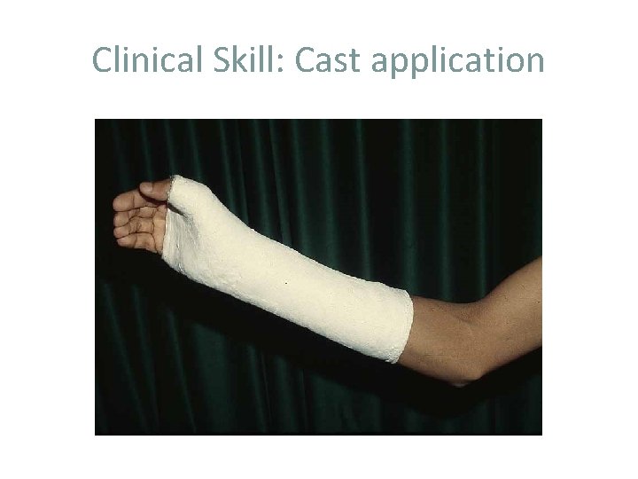 Clinical Skill: Cast application 