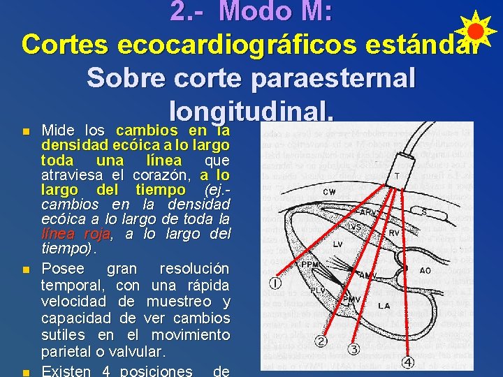 2. - Modo M: Cortes ecocardiográficos estándar Sobre corte paraesternal longitudinal. n n n