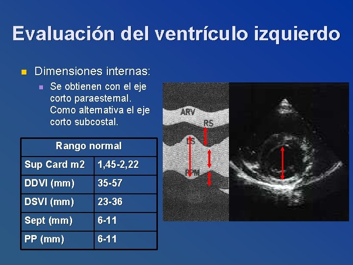 Evaluación del ventrículo izquierdo n Dimensiones internas: n Se obtienen con el eje corto