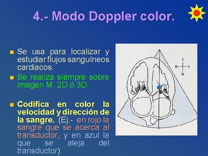 4. - Modo Doppler color. n n n Se usa para localizar y estudiar