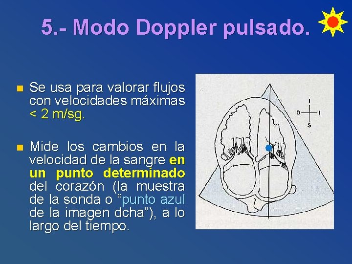 5. - Modo Doppler pulsado. n Se usa para valorar flujos con velocidades máximas