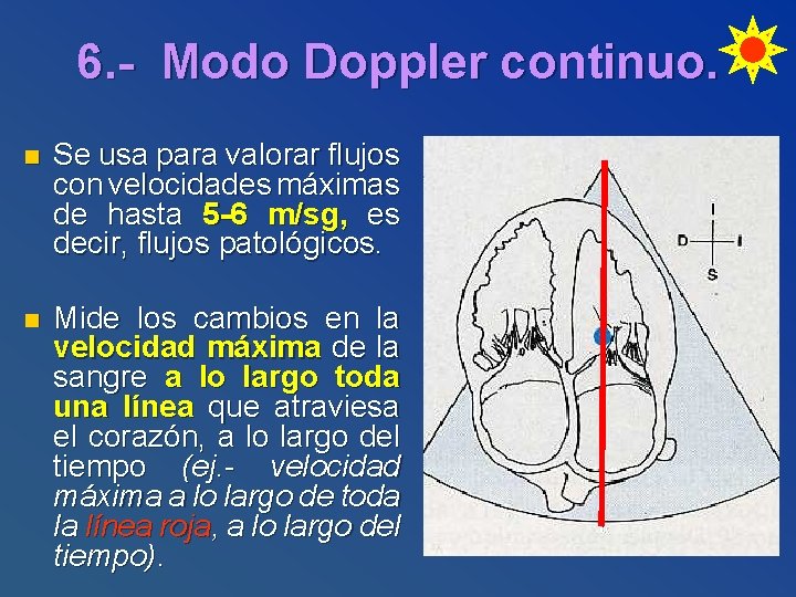 6. - Modo Doppler continuo. n Se usa para valorar flujos con velocidades máximas