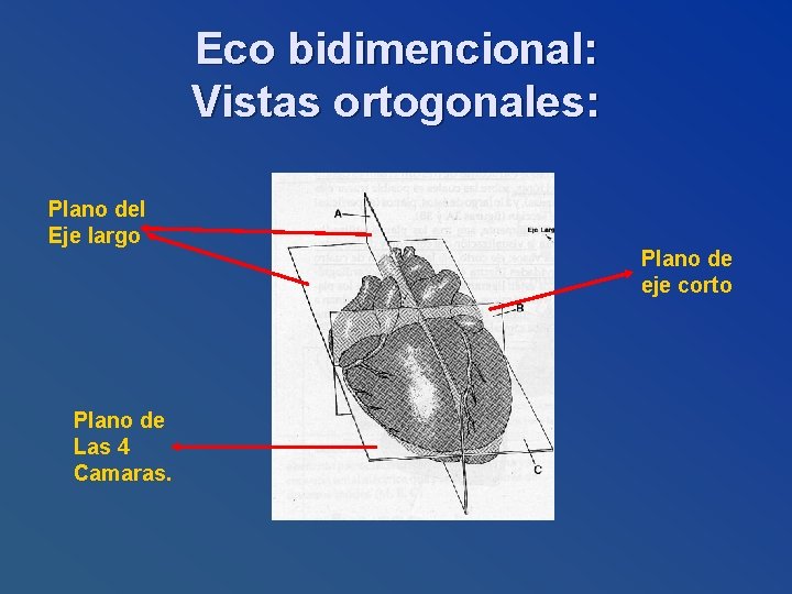 Eco bidimencional: Vistas ortogonales: Plano del Eje largo Plano de Las 4 Camaras. Plano