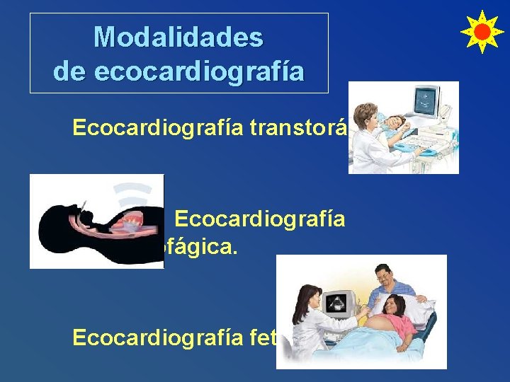 Modalidades de ecocardiografía Ecocardiografía transtorácica. Ecocardiografía transesofágica. Ecocardiografía fetal. 