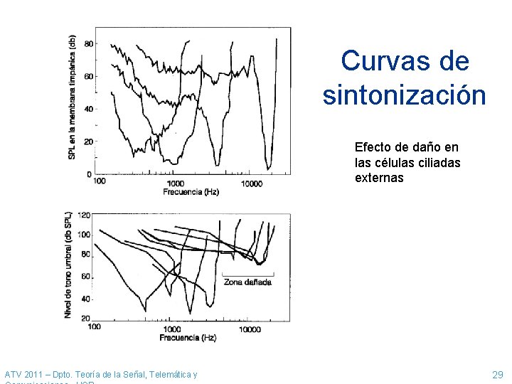 Curvas de sintonización Efecto de daño en las células ciliadas externas ATV 2011 – Curvas de sintonización Efecto de daño en las células ciliadas externas ATV 2011 –