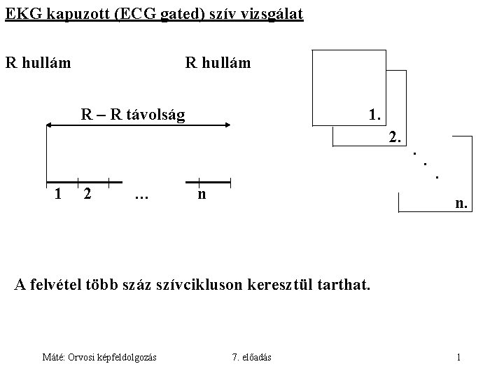 EKG kapuzott (ECG gated) szív vizsgálat R hullám R – R távolság 1. 2.