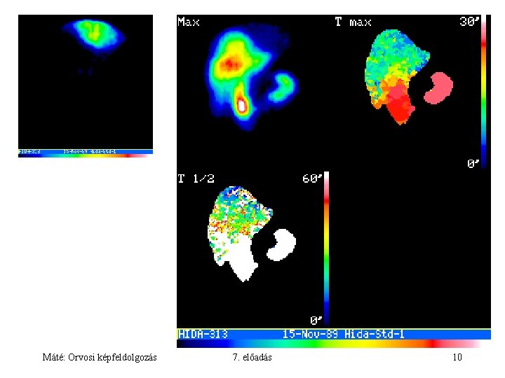 Máté: Orvosi képfeldolgozás 7. előadás 10 