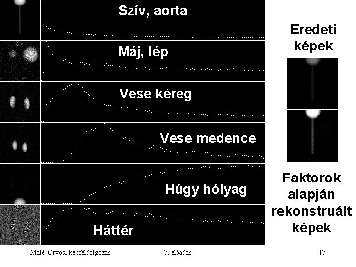 Szív, aorta Máj, lép Eredeti képek Vese kéreg Vese medence Húgy hólyag Háttér Máté: