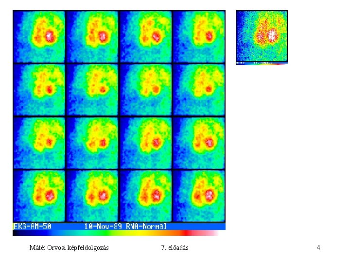 Máté: Orvosi képfeldolgozás 7. előadás 4 