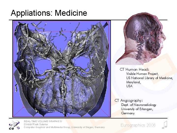 Appliations: Medicine CT Human Head: Visible Human Project, US National Library of Medicine, Maryland, Appliations: Medicine CT Human Head: Visible Human Project, US National Library of Medicine, Maryland,