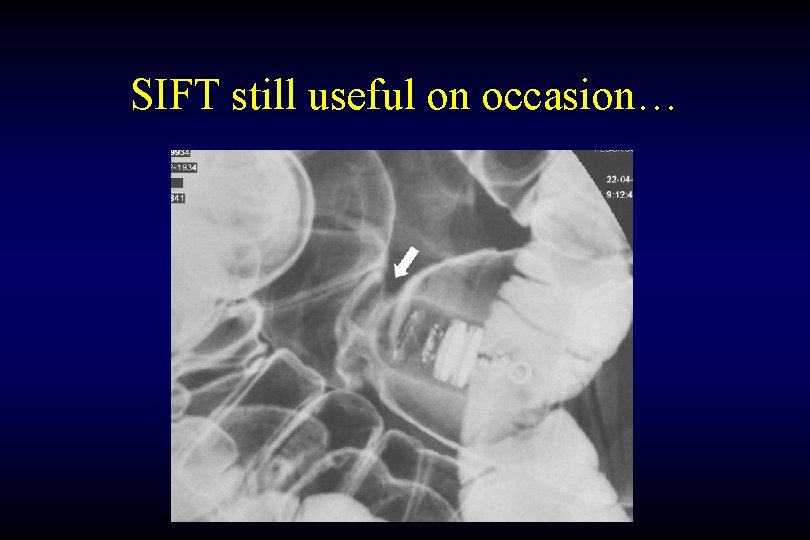 SIFT still useful on occasion… 