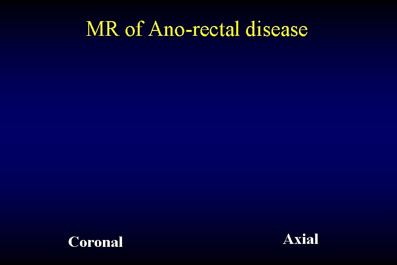 MR of Ano-rectal disease Coronal Axial 