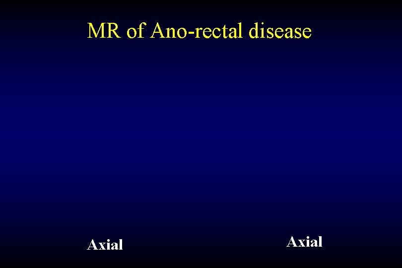 MR of Ano-rectal disease Axial 