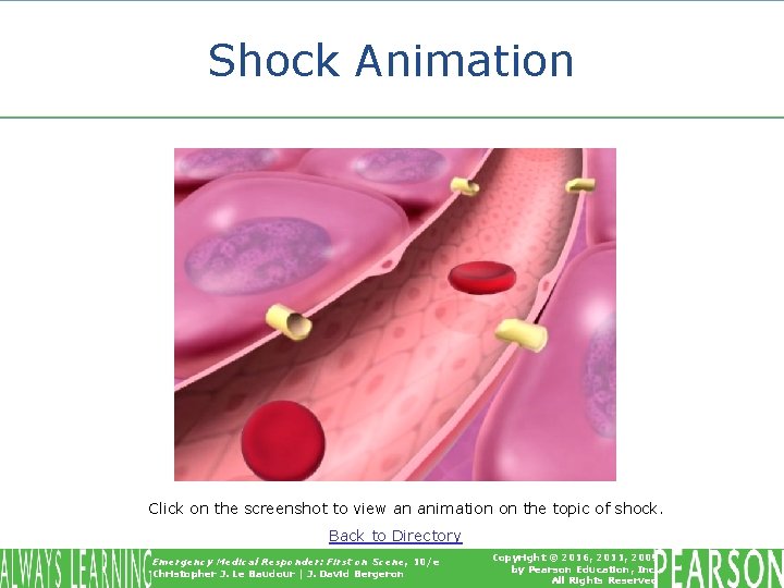 Shock Animation Click on the screenshot to view an animation on the topic of