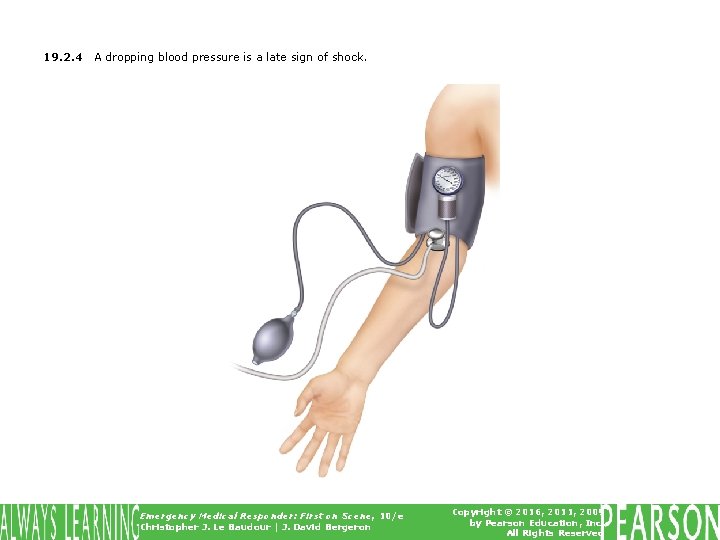 19. 2. 4 A dropping blood pressure is a late sign of shock. Emergency