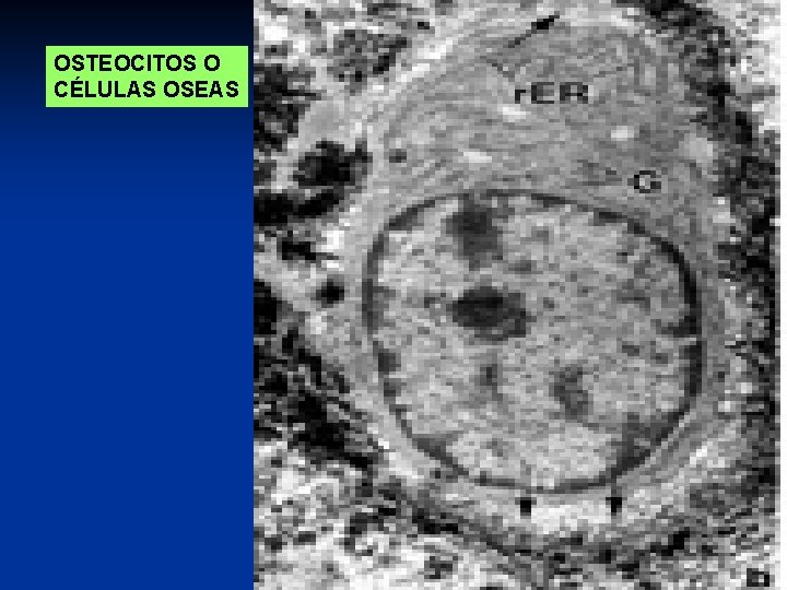 OSTEOCITOS O CÉLULAS OSEAS 