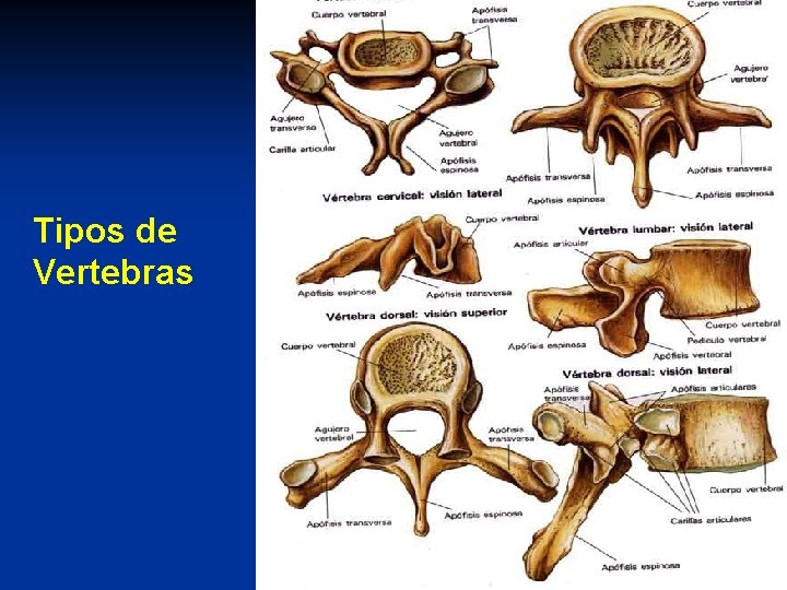 Tipos de Vertebras 