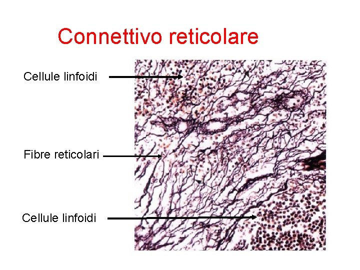 Connettivo reticolare Cellule linfoidi Fibre reticolari Cellule linfoidi 