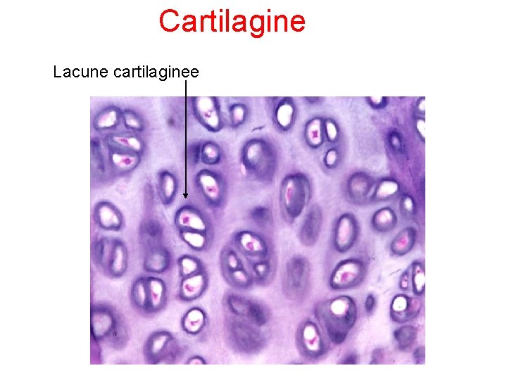 Cartilagine Lacune cartilaginee 