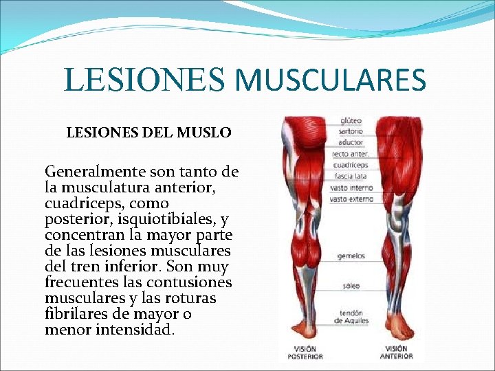 LESIONES MUSCULARES LESIONES DEL MUSLO Generalmente son tanto de la musculatura anterior, cuadriceps, como