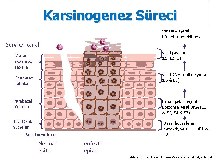 Karsinogenez Süreci Virüsün epitel hücrelerine ekilmesi Servikal kanal Viral yayılım (L 1, L 2,