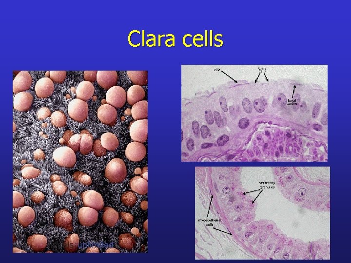 Clara cells 