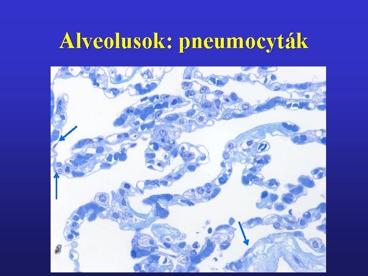 Alveolusok: pneumocyták 