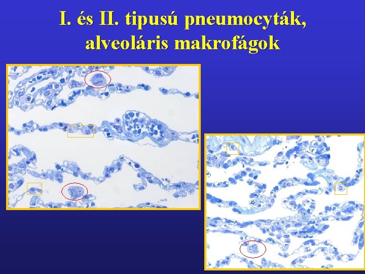 I. és II. tipusú pneumocyták, alveoláris makrofágok 