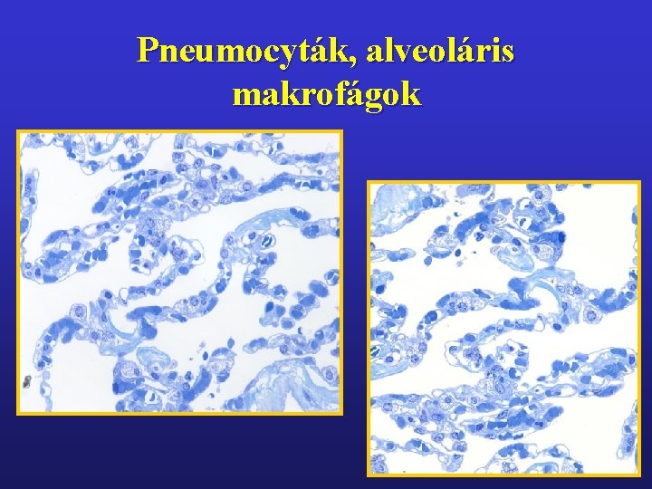 Pneumocyták, alveoláris makrofágok 