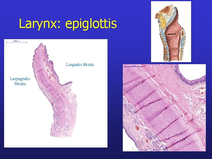 Larynx: epiglottis Lingualis felszín Laryngealis felszín 