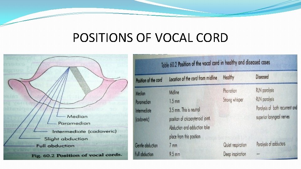 POSITIONS OF VOCAL CORD 