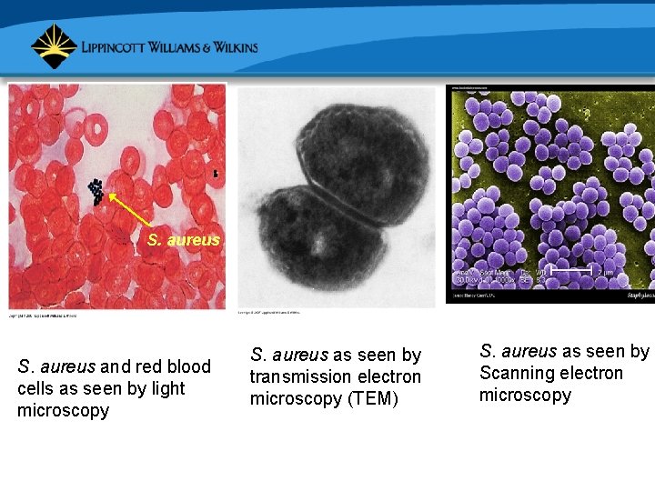 S. aureus and red blood cells as seen by light microscopy S. aureus as