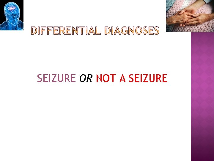 SEIZURE OR NOT A SEIZURE 