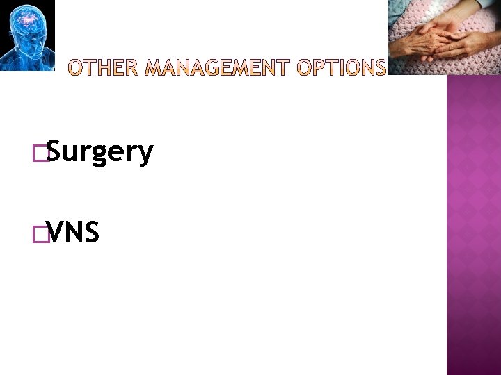 �Surgery �VNS 