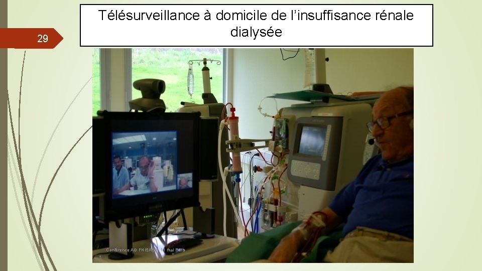 29 Télésurveillance à domicile de l’insuffisance rénale dialysée Conférence AG FNISASIC 11 mai Paris
