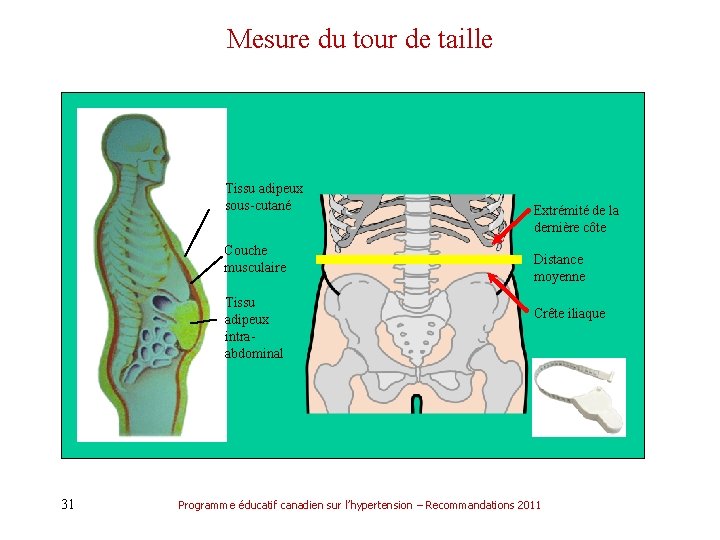 Mesure du tour de taille Tissu adipeux sous-cutané Extrémité de la dernière côte Couche