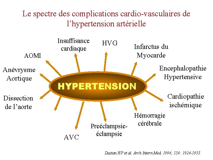 Le spectre des complications cardio-vasculaires de l’hypertension artérielle AOMI Anévrysme Aortique Insuffisance cardiaque HVG