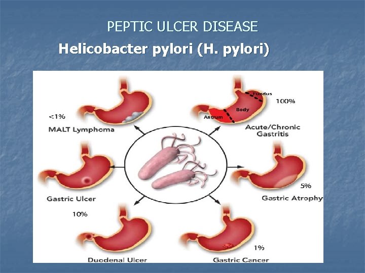 PEPTIC ULCER DISEASE Helicobacter pylori (H. pylori) 