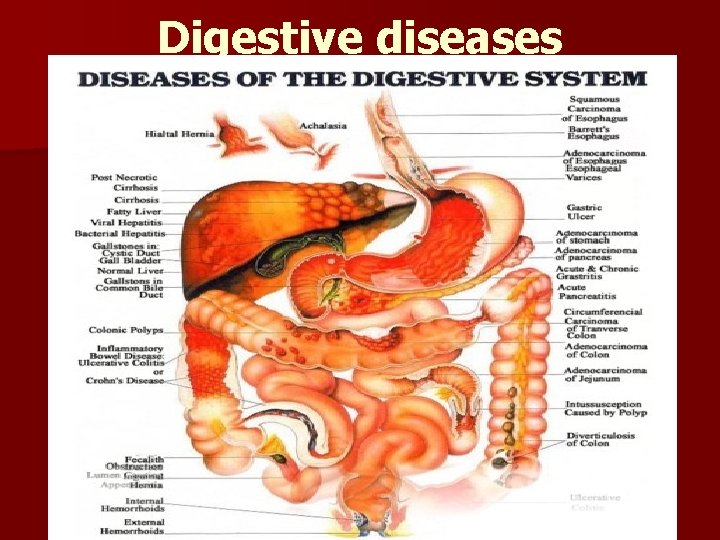 Digestive diseases 