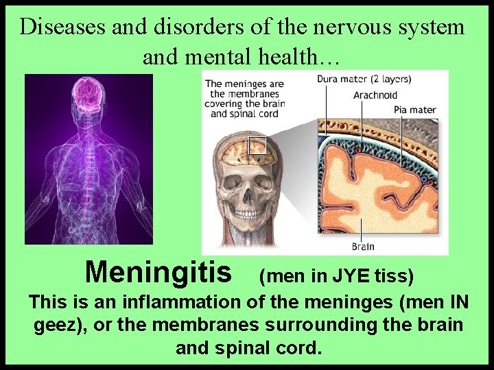 Diseases and disorders of the nervous system and mental health… Meningitis (men in JYE