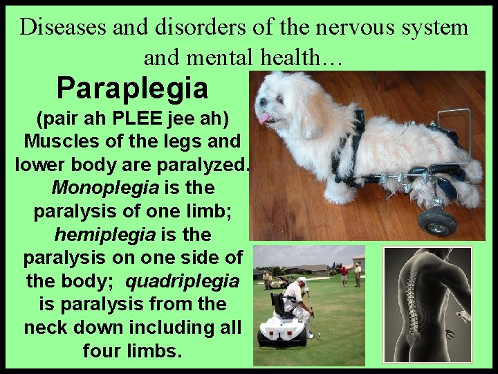 Diseases and disorders of the nervous system and mental health… Paraplegia (pair ah PLEE