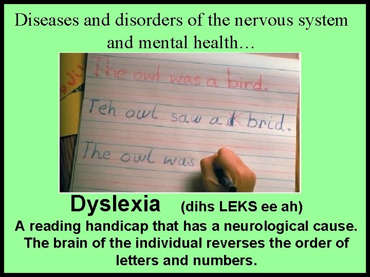 Diseases and disorders of the nervous system and mental health… Dyslexia (dihs LEKS ee