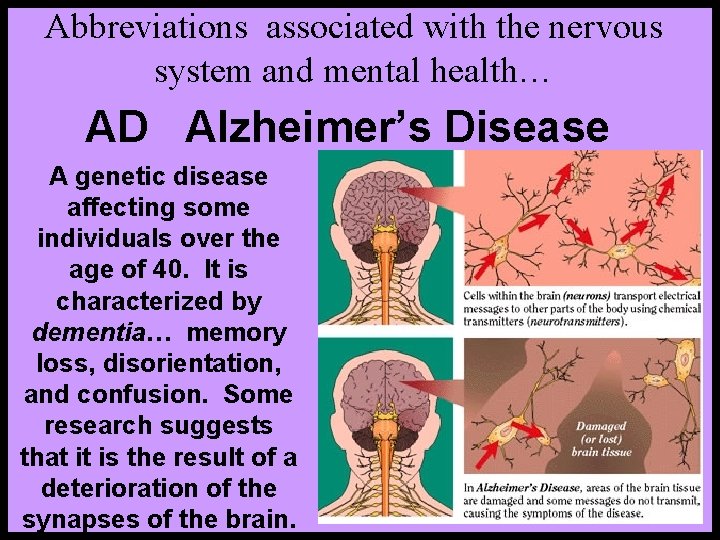 Abbreviations associated with the nervous system and mental health… AD Alzheimer’s Disease A genetic