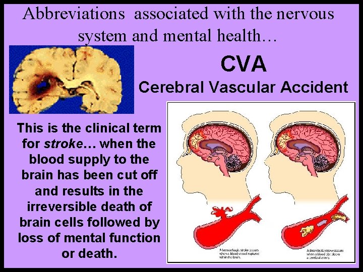 Abbreviations associated with the nervous system and mental health… CVA Cerebral Vascular Accident This