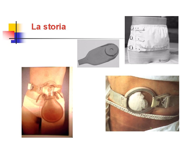 La storia 