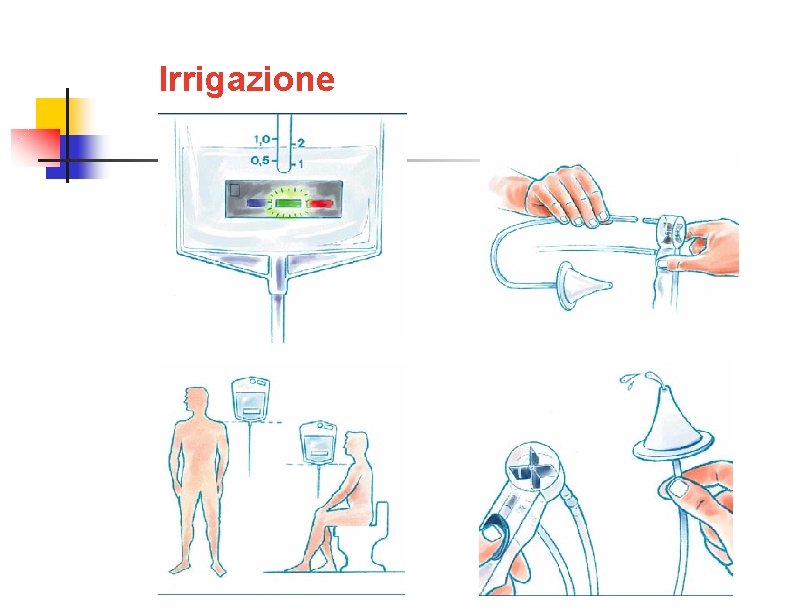 Irrigazione 